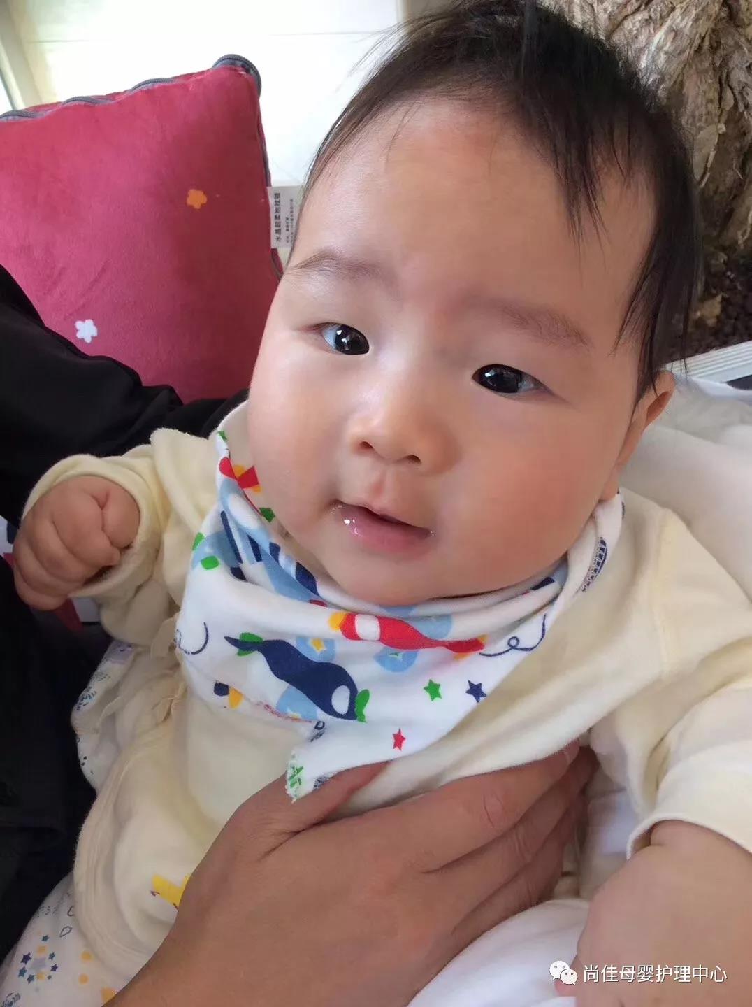 尚佳專業月嫂丨新生兒常見問題丨寶寶的乳痂（頭垢）